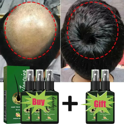 Fast Hair Growth Serum Spray Anti Hair Loss Prevent Baldness Scalp