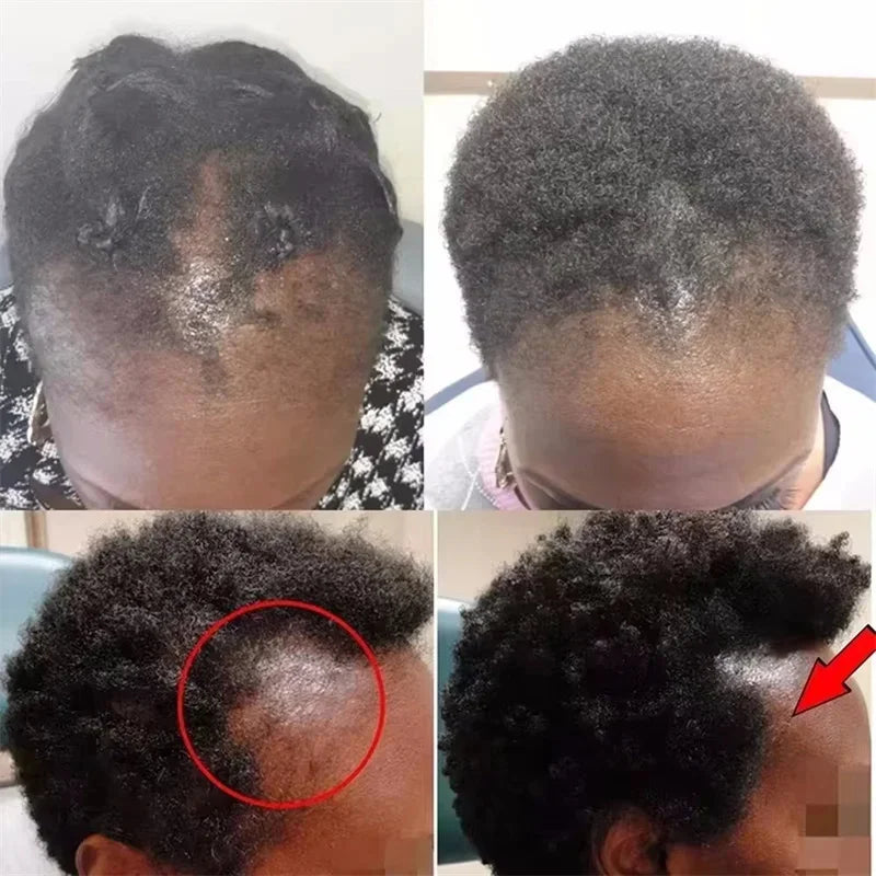 Hair Growth Serum 7 Days Fast Regrowth Essential Capsule Anti Hair