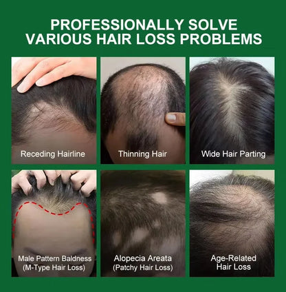 Fast Hair Growth Serum Spray Anti Hair Loss Prevent Baldness Scalp