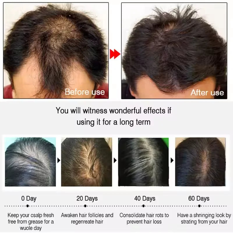 7 Days Fast Batana Oil Hair Growth Serum Anti-loss Hair Regrowth