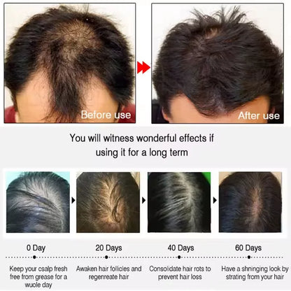7 Days Fast Batana Oil Hair Growth Serum Anti-loss Hair Regrowth