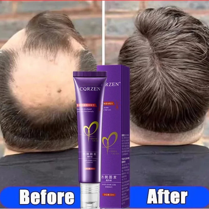 Hair Growth Serum 7 Days Fast Regrowth Essential Capsule Anti Hair