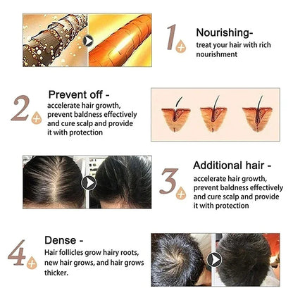 Hair Growth Serum 7 Days Fast Regrowth Essential Capsule Anti Hair