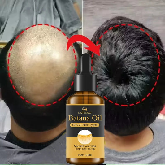 7 Days Fast Batana Oil Hair Growth Serum Anti-loss Hair Regrowth