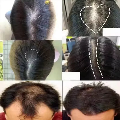 7 Days Fast Batana Oil Hair Growth Serum Anti-loss Hair Regrowth
