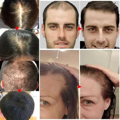 7 Days Fast Batana Oil Hair Growth Serum Anti-loss Hair Regrowth