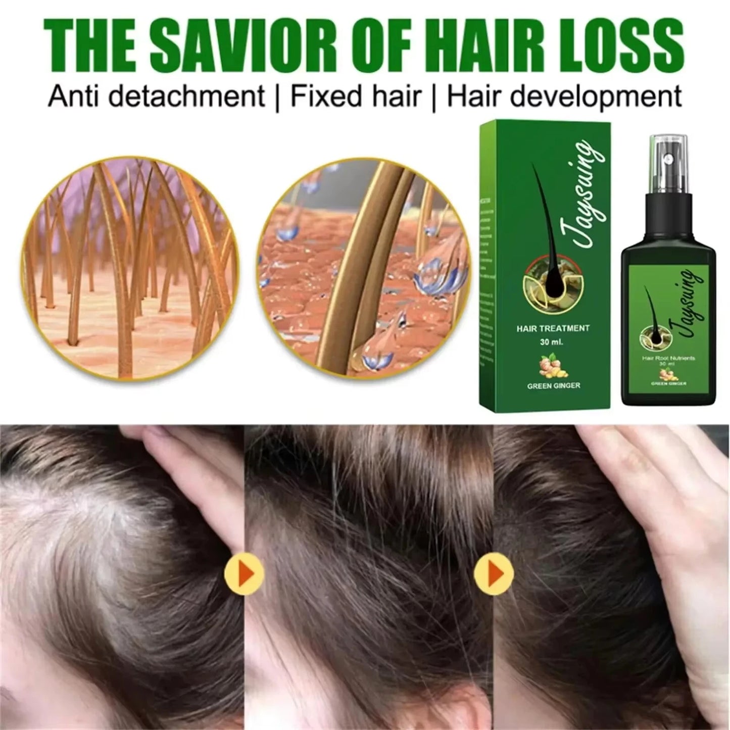 Fast Hair Growth Serum Spray Anti Hair Loss Prevent Baldness Scalp