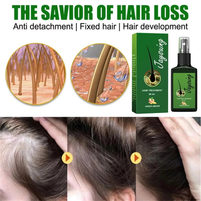 Fast Hair Growth Serum Spray Anti Hair Loss Prevent Baldness Scalp