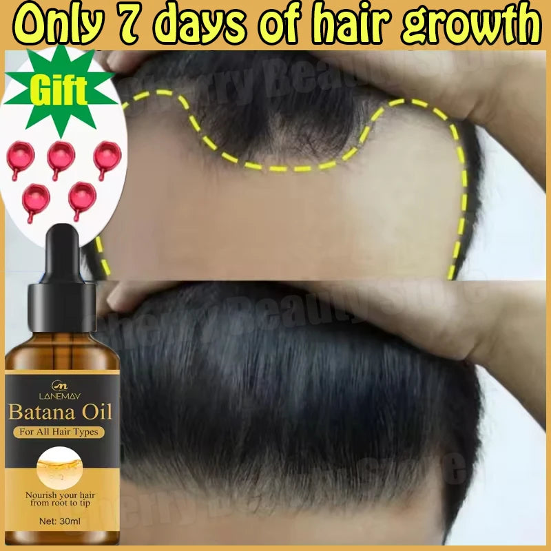 7 Days Fast Batana Oil Hair Growth Serum Anti-loss Hair Regrowth