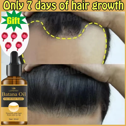 7 Days Fast Batana Oil Hair Growth Serum Anti-loss Hair Regrowth