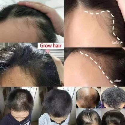 Hair Growth Serum 7 Days Fast Regrowth Essential Capsule Anti Hair