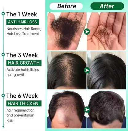 Fast Hair Growth Serum Spray Anti Hair Loss Prevent Baldness Scalp