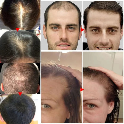 Fast Hair Growth Serum Spray Anti Hair Loss Prevent Baldness Scalp